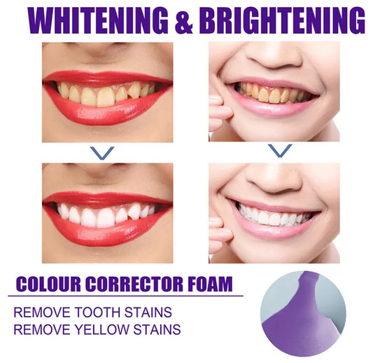 Whitening Teeth Pen V34